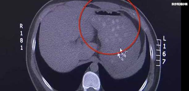 淘宝退款的陷阱,谨防诈骗请勿上当