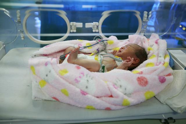 因为孕期一直抽烟生下的胎儿图片,孕妇吸烟生的孩子