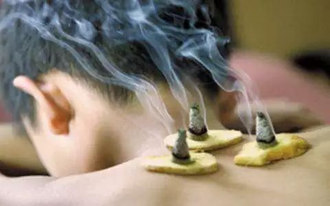 三伏灸一灸抵三灸,老话说三伏灸一灸