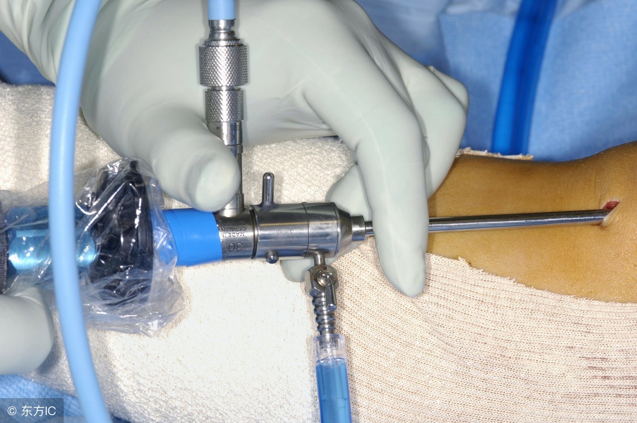 漏斗胸严重影响心肺功能,漏斗胸手术后可能出现的后遗症