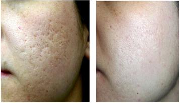 爱是一道光束,爱是一道光量子力学