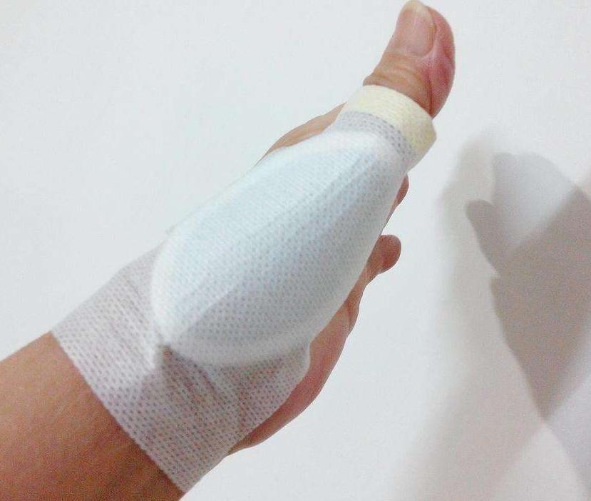 腱鞘炎千万别手术知乎,腱鞘炎妈妈手千万别硬撑