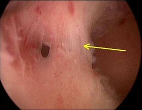 大姨妈期间促进经血排出,大姨妈期间如何保持经血通畅