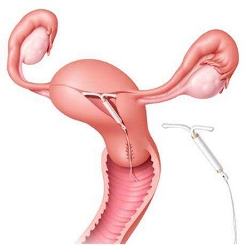 大姨妈期间促进经血排出,大姨妈期间如何保持经血通畅