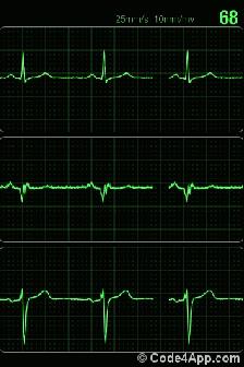 这项最便宜的检查，你做了吗？