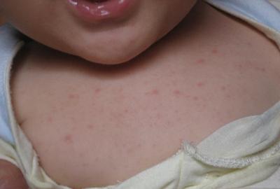 哪款婴儿祛痱爽身露好用,夏季祛痱爽身露测评