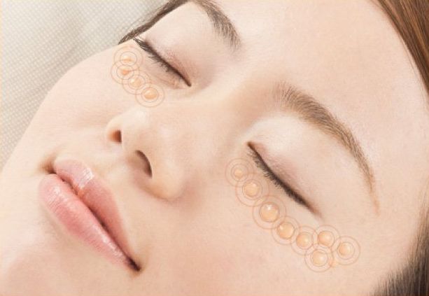 不用针挑、手挤,一涂一撕,脂肪粒自动脱落,两周见效