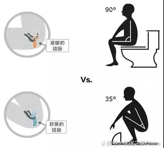 上厕所的正确姿势蹲,女生亚洲蹲的正确方法