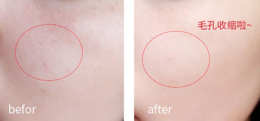 林允高光面膜推荐哪个,林允护肤视频推荐什么面膜