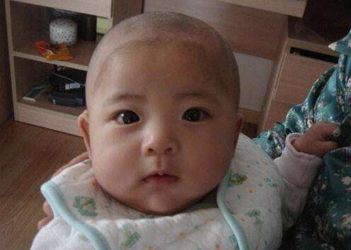 身体这4个部位长痣的孩子,十有八九是富贵命,看下你家孩子有吗