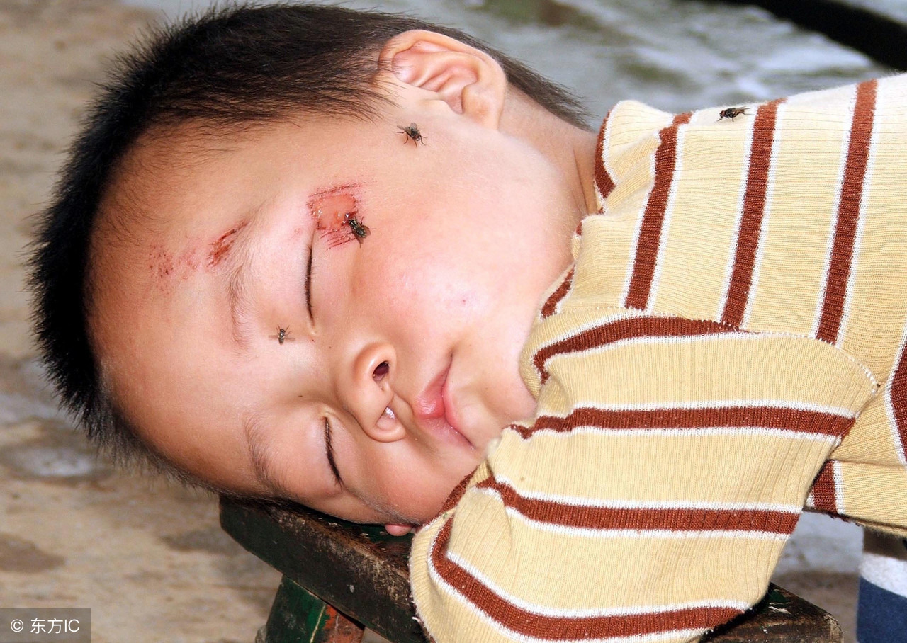 蚊虫叮咬用什么中草药洗效果好,外用最能治疗蚊虫叮咬的中草药