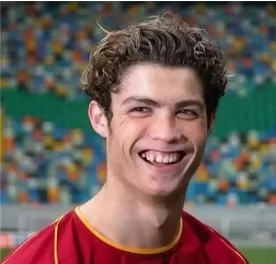 c罗整容了吗,c罗整牙颜值变化