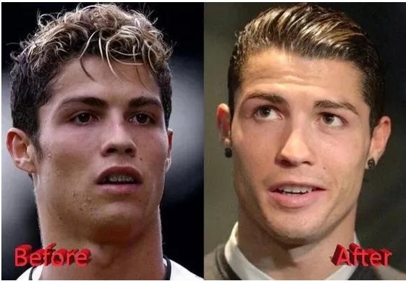 c罗整容了吗,c罗整牙颜值变化