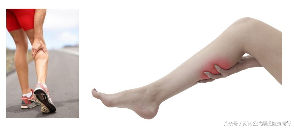 静脉曲张郑大一附院看哪个科,郑大一附院硬化剂治疗静脉曲张