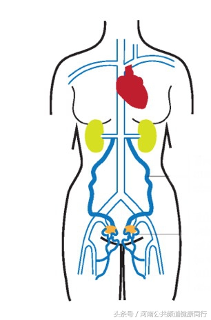 静脉曲张郑大一附院看哪个科,郑大一附院硬化剂治疗静脉曲张