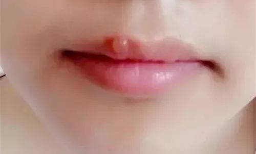 为什么要查优生四项,优生四项有必要检查么