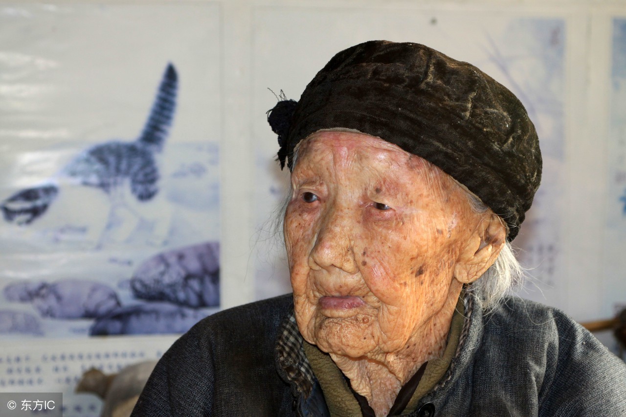 中年人有老年斑怎么预防,老年斑严重的怎么办