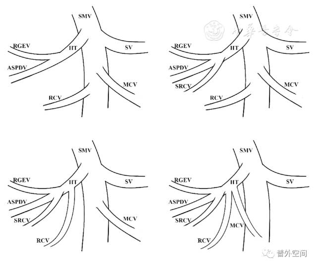 腹腔镜右半结肠癌手术步骤,腹腔镜右半结肠癌根治术术后护理