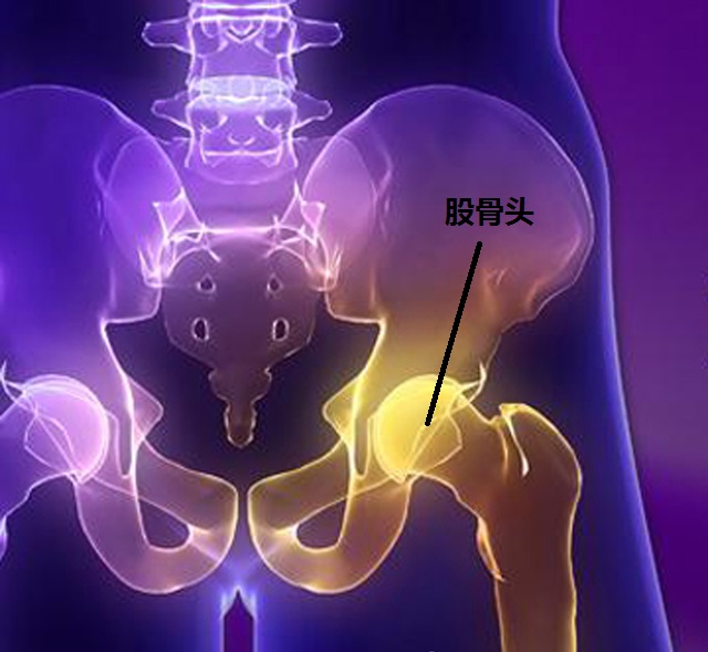 吃钙片能预防股骨头坏死吗,按摩腹股沟预防股骨头坏死