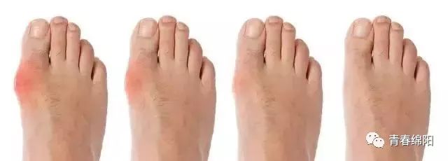 女子突然中毒晕倒罪魁祸首竟是脚上穿的高跟鞋~