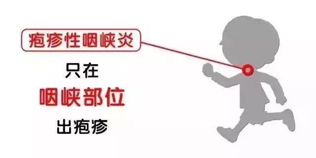 手足口病跟妈妈分离,手足口和疱疹性咽峡炎怎么区别