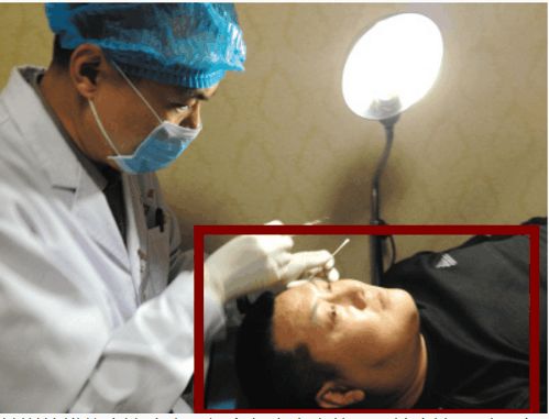 河北模仿赵本山,模仿赵本山整容最像的人