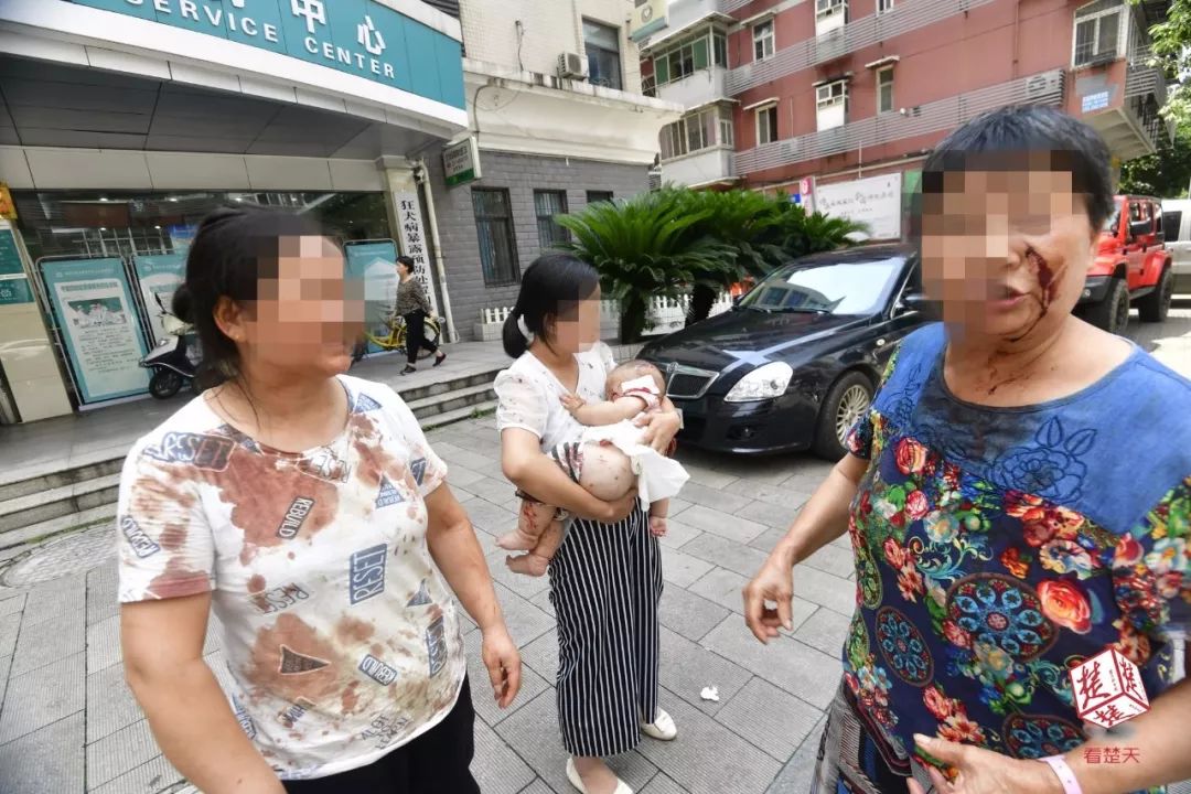 遇到恶狗咬小狗咋办,遇到恶犬追咬如何自救