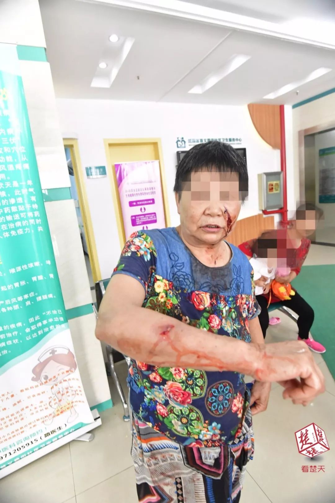 遇到恶狗咬小狗咋办,遇到恶犬追咬如何自救