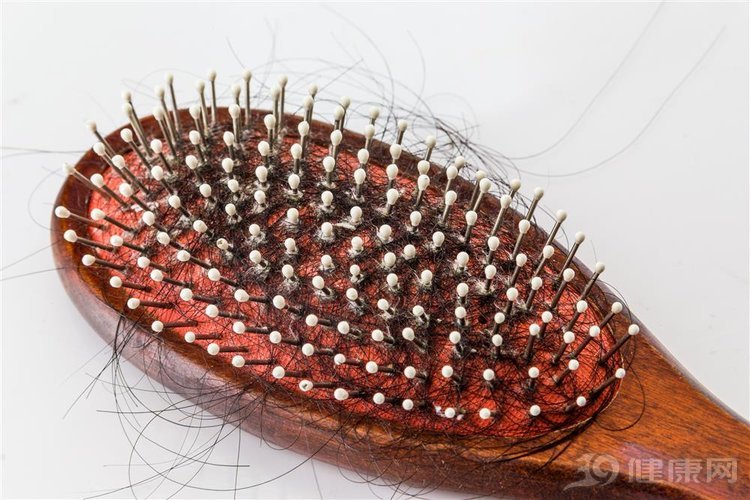 发际线后移脱发的原因和治疗方法,额头两边发际线后移是秃头吗