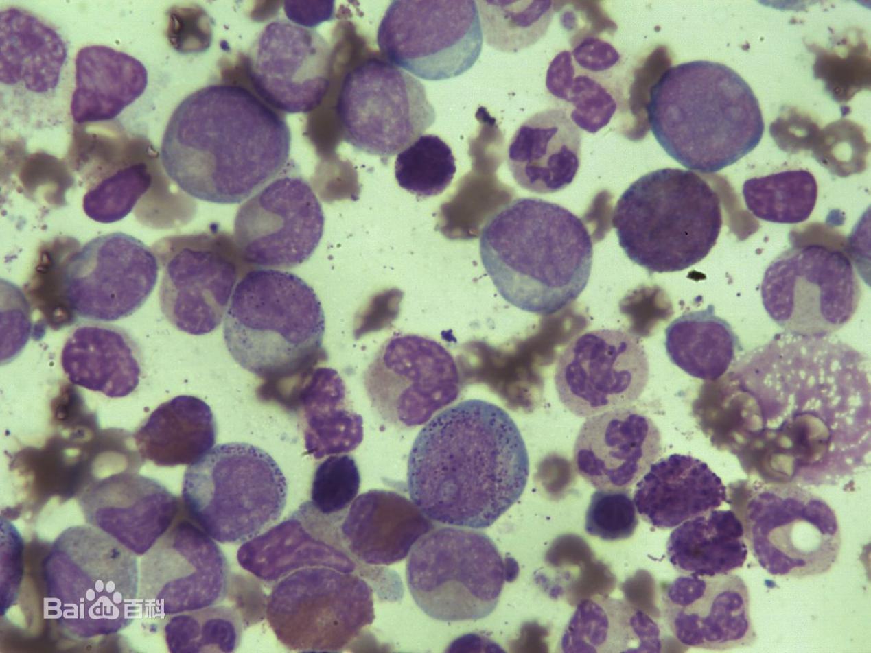 现实比《我不是药神》更残酷:创新药比印度仿制药更稀缺|沈竞康