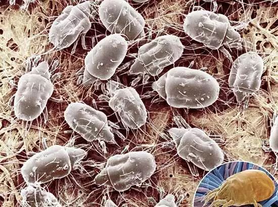 螨虫的三大罪状导致宝宝感染疾病,小孩出现这几种症状说明螨虫成堆