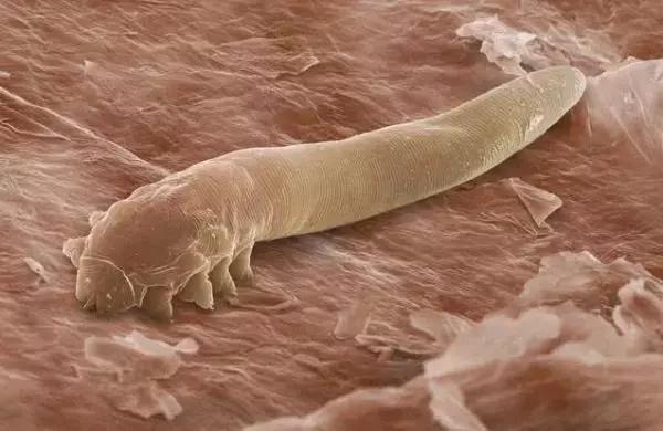 挤挤挤！鼻子挤出“小黄虫”,竟全是它的粪便，记住2方法排光它