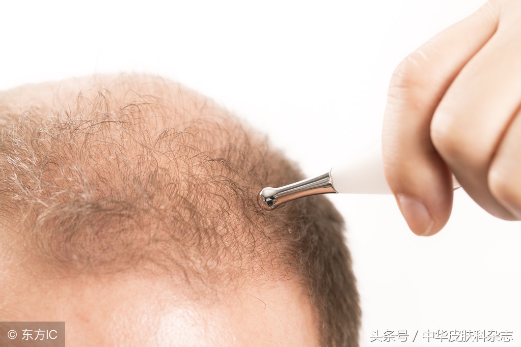 毛发毛囊移植需要什么设备,毛发毛囊移植案例