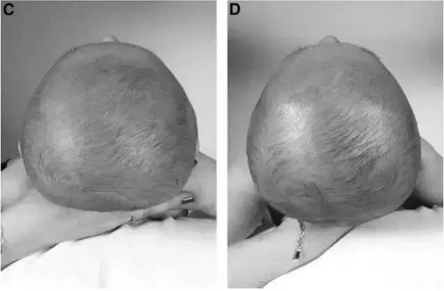宝宝睡圆头平躺要睡多久,5个月宝宝头睡平了还能圆回来吗