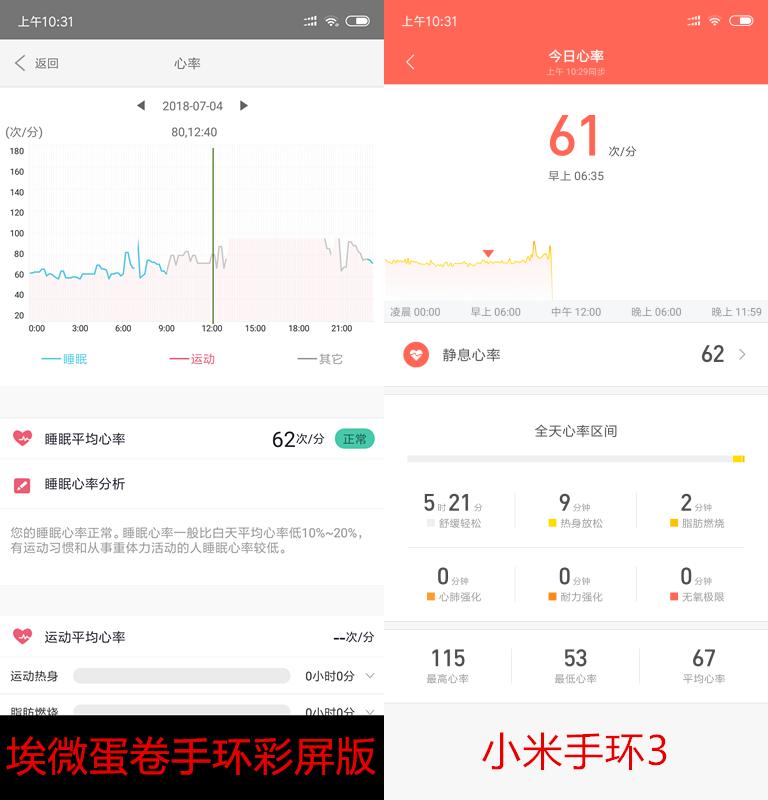 埃微蛋卷彩屏手环对比小米手环3，你喜欢哪一款？