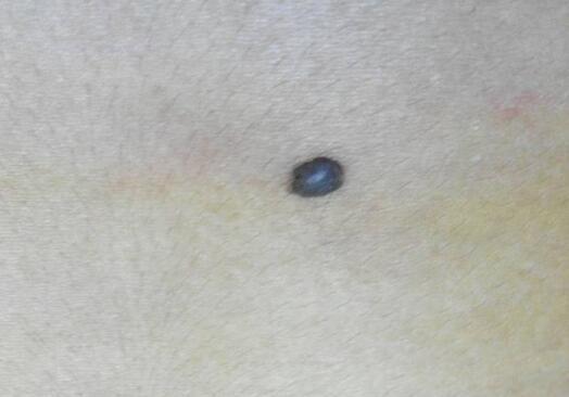 此处长毛的人命里有财非官即富,胸口长毛的人财运好吗