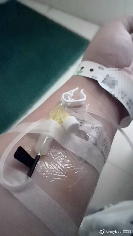 动画演示子宫全切手术,子宫附件全切术动画