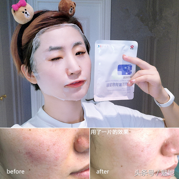 国产医美面膜10大品牌,最全国产医用面膜