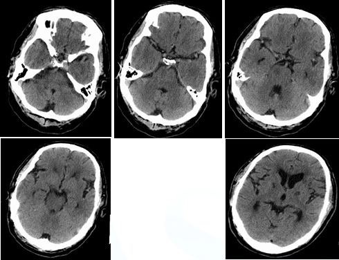 心血管内科急救流程,急诊静脉用药方法