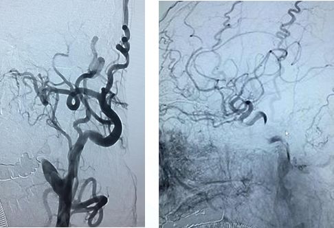 心血管内科急救流程,急诊静脉用药方法