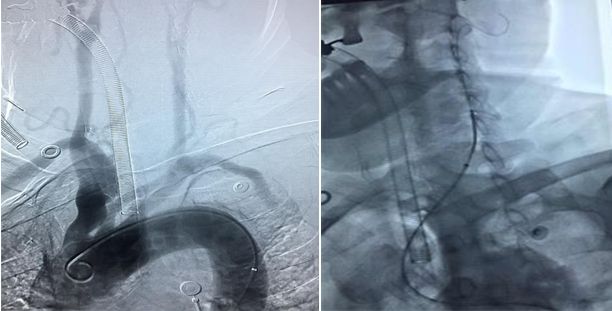 心血管内科急救流程,急诊静脉用药方法