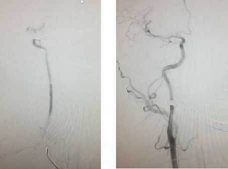 心血管内科急救流程,急诊静脉用药方法