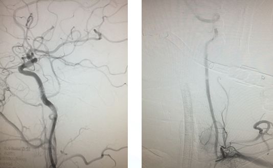 心血管内科急救流程,急诊静脉用药方法