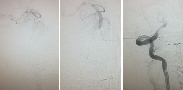 心血管内科急救流程,急诊静脉用药方法