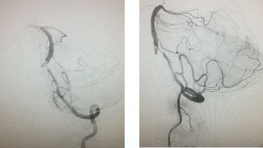 心血管内科急救流程,急诊静脉用药方法