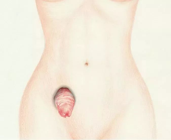 世界首位活体移植的医生,世界第一例小肠活体移植医生