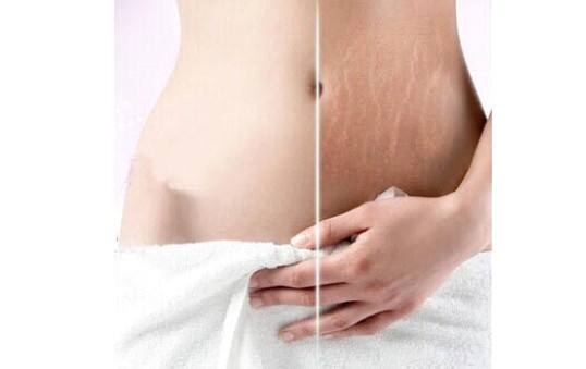 目前孕妇橄榄油十大排行有哪些啊,十大公认好用的孕妇橄榄油