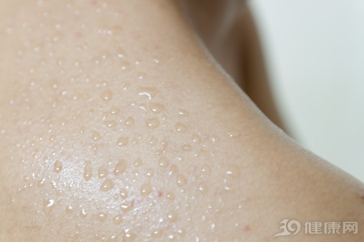 请问医生汗斑是拿什么来治疗,医生为什么说汗斑不用治