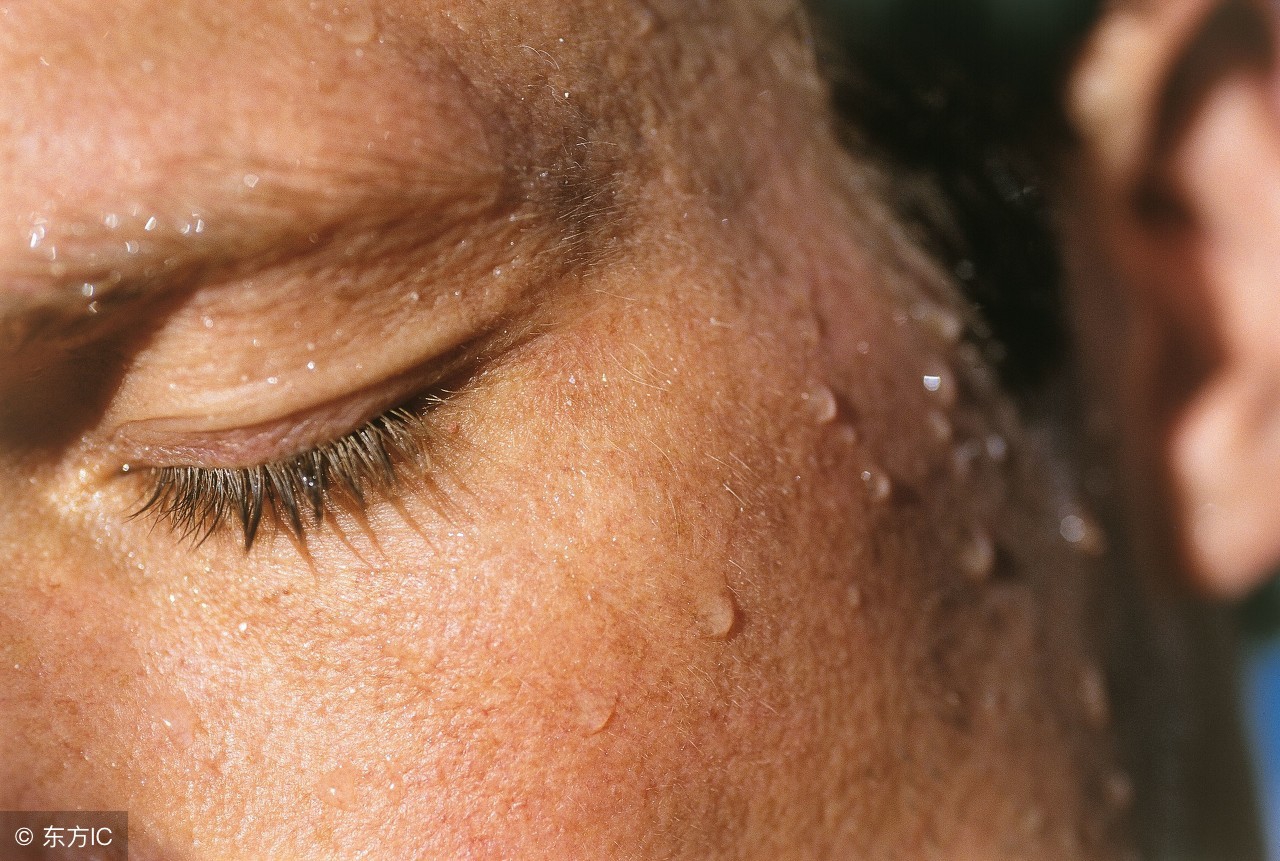 汗疱疹症状轻重的判断,汗疱疹有什么症状呢