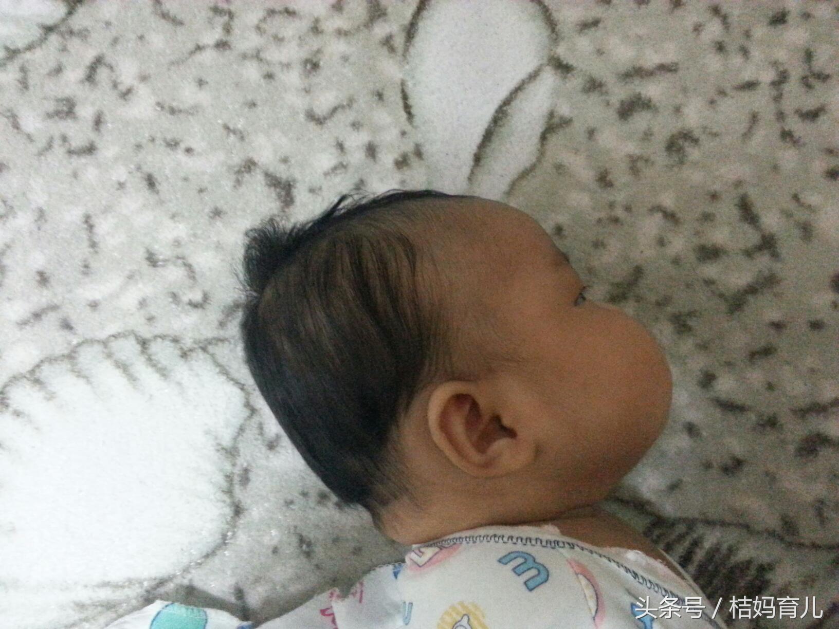 孕32周羊水破了还有点血,孕32周羊水早破保胎4天有淡红色血